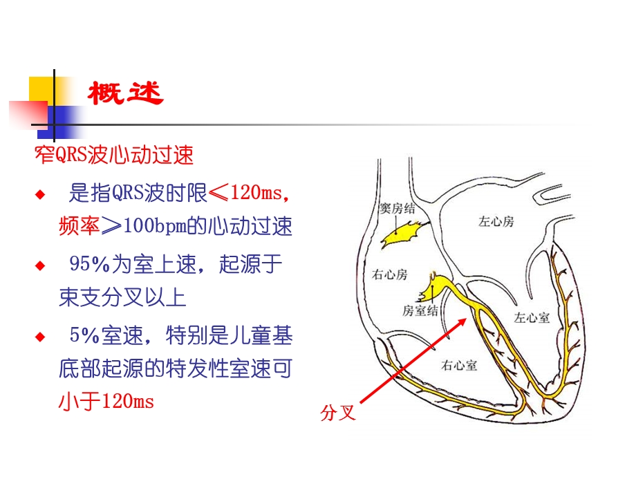 【精品】窄QRS波心动过速83.ppt_第2页