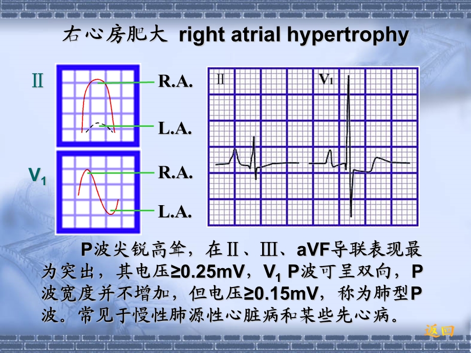 心电图中.ppt_第2页