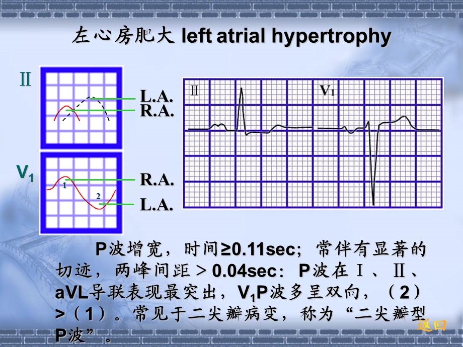 心电图中.ppt_第3页