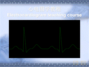 心电图中.ppt