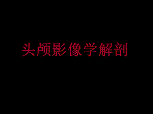 头颅影像学解剖.ppt