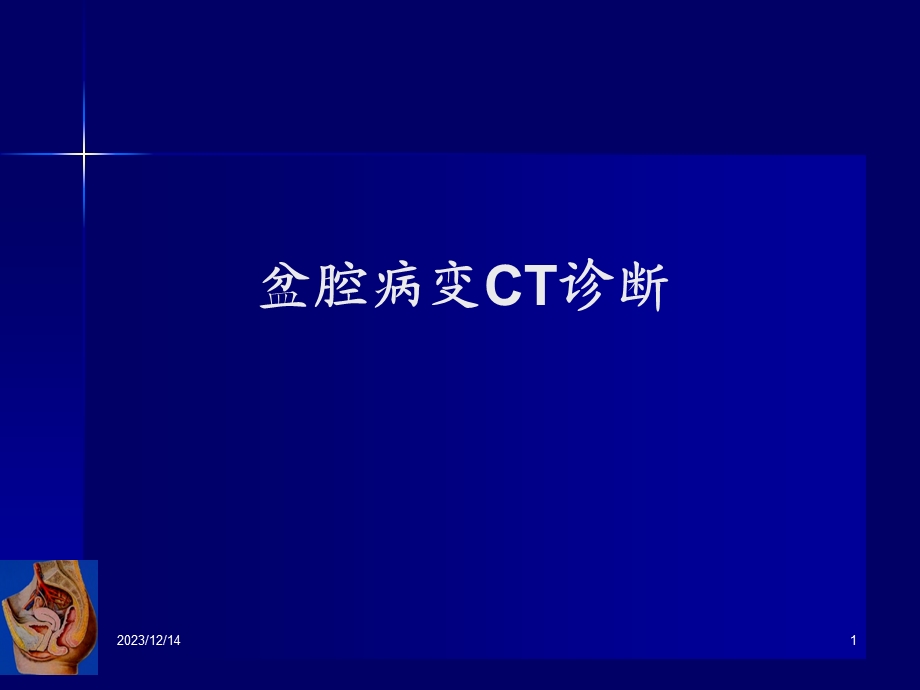 女性生殖系统疾病CT诊断.ppt_第1页