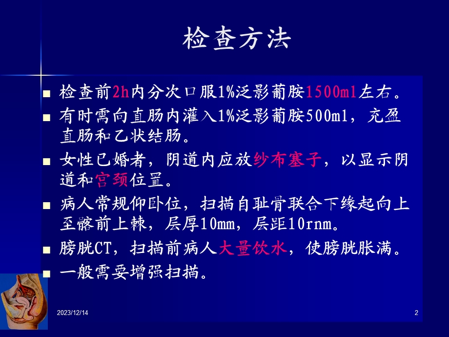 女性生殖系统疾病CT诊断.ppt_第2页