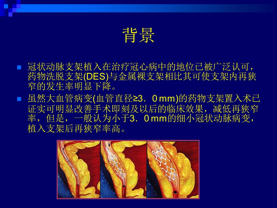 国产西罗莫司药物支架对小血管病变的疗效评价.ppt_第2页