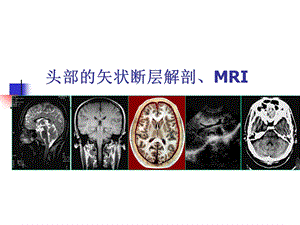 头部的矢状断层解剖应用.ppt