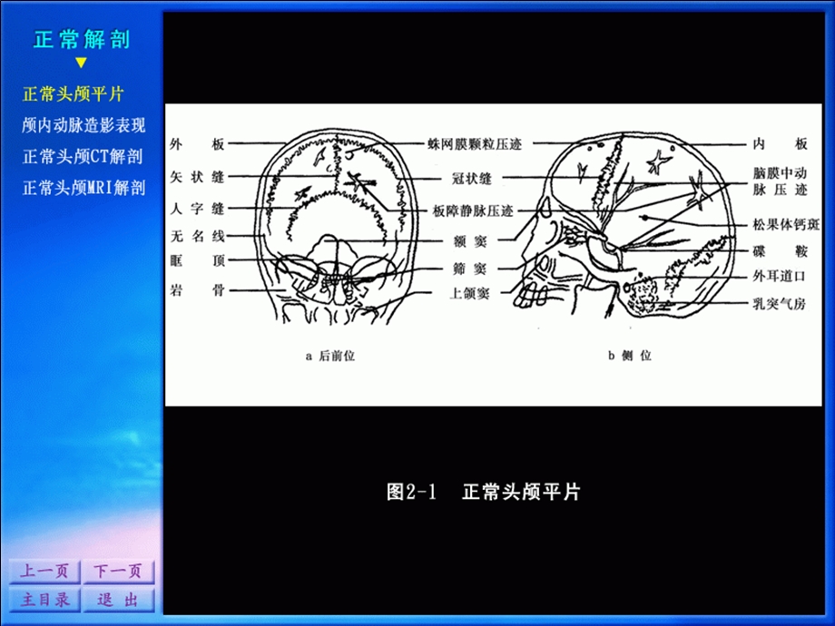 影像诊断学系列图谱神经系统.ppt_第2页