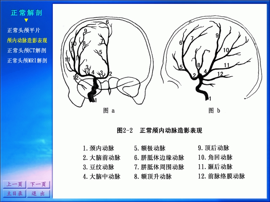 影像诊断学系列图谱神经系统.ppt_第3页