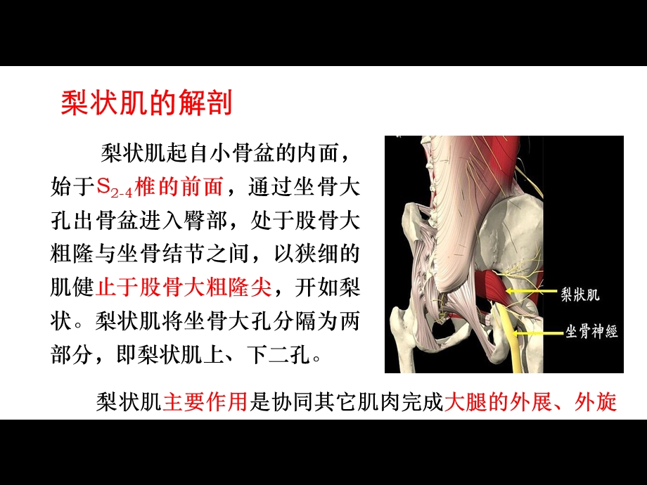 梨状肌综合征的影像诊断.ppt_第3页