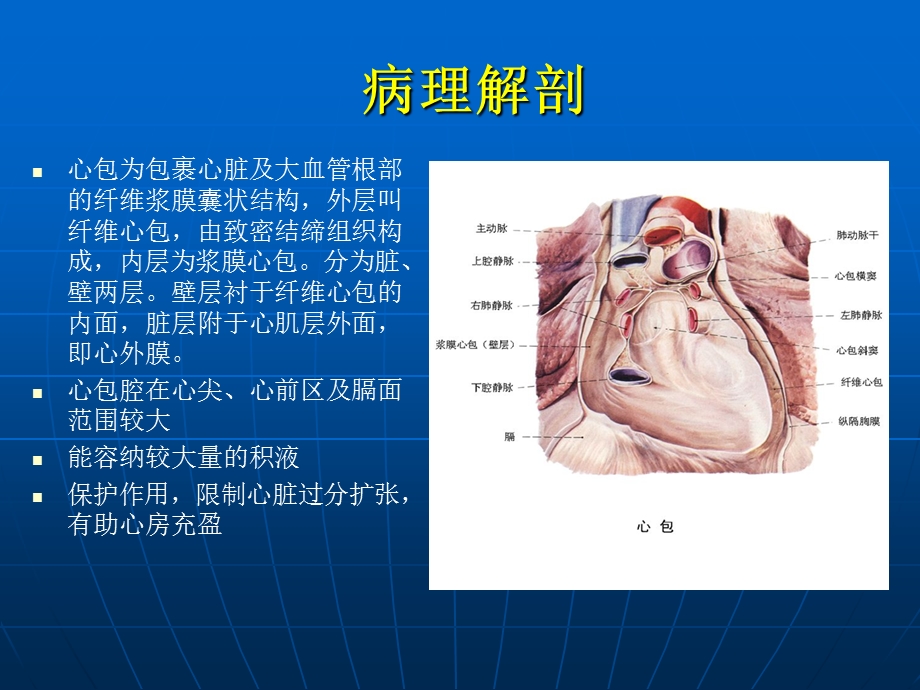 【精品】心包积液.ppt_第2页