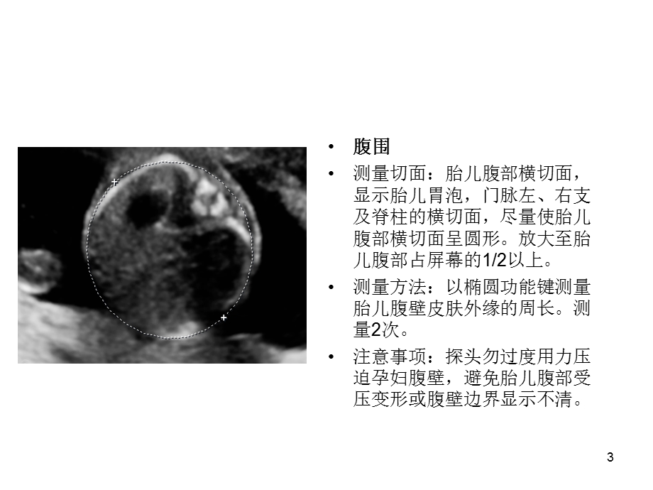 产科超声标准切面25张图.ppt_第3页