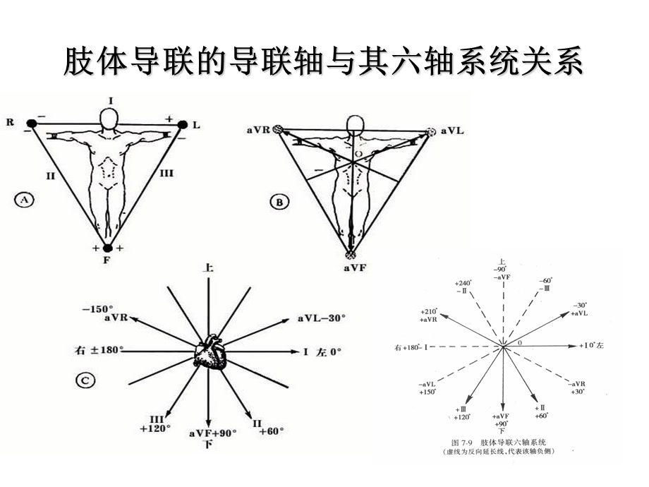 围术期常见的异常心电图分析.ppt_第3页