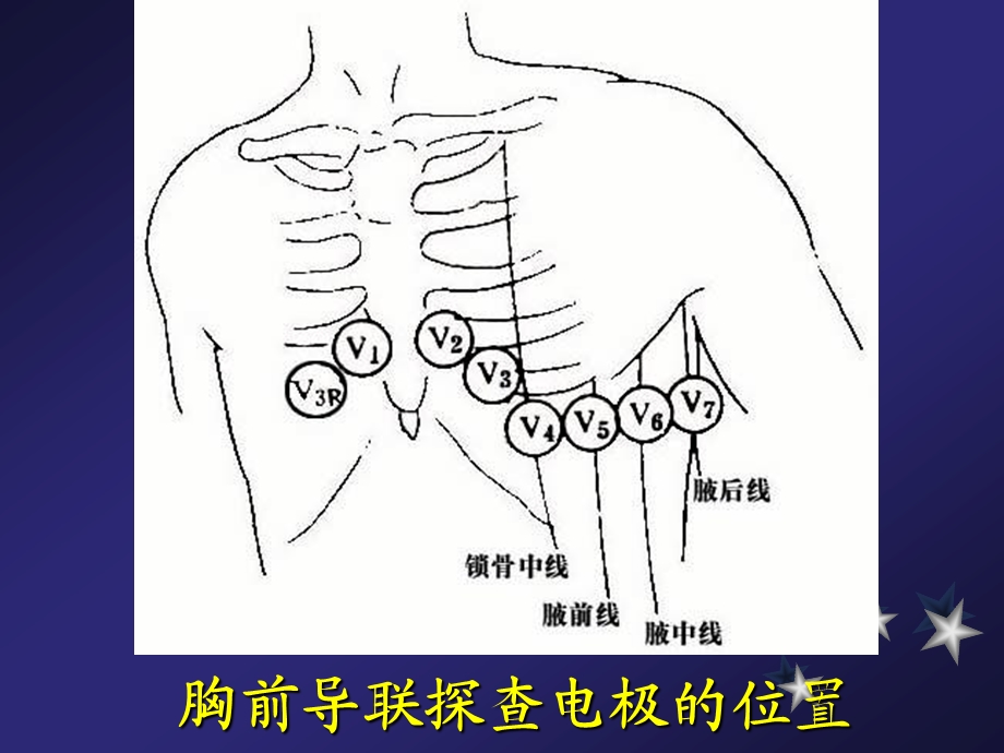 心电图幻灯片内一科[优质文档].ppt_第2页