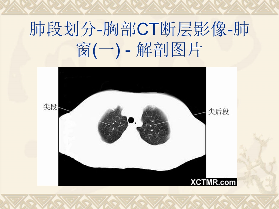 医学系列 胸、上腹和盆腔CT图谱.ppt_第3页