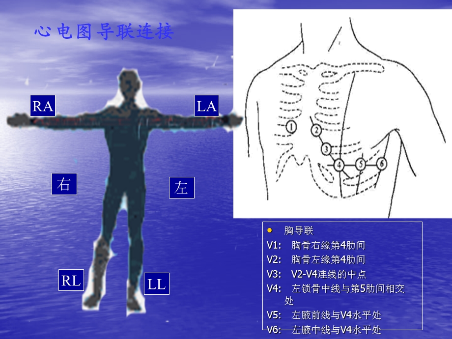 临床心电图教学.ppt_第3页