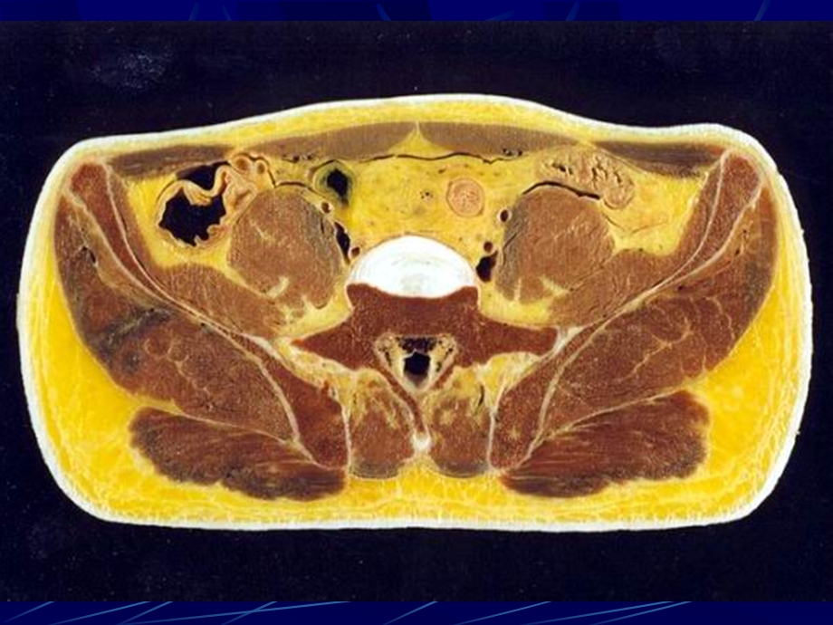 男性盆部和会阴断层解剖.ppt_第2页