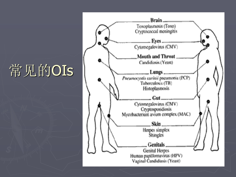 艾滋病的肺部并发症.ppt_第2页