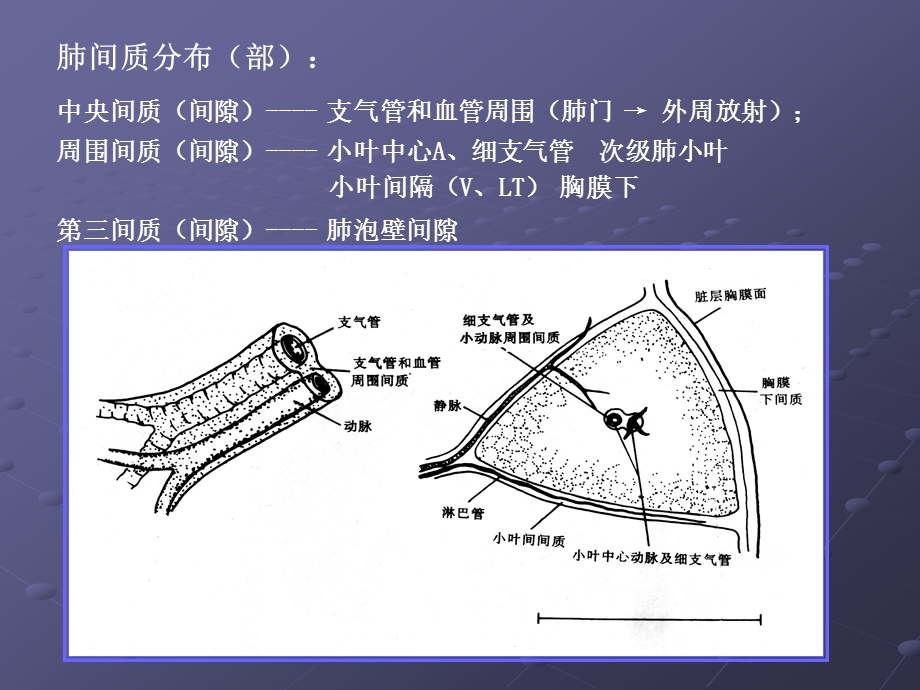 肺间质疾病影像表现.ppt_第3页