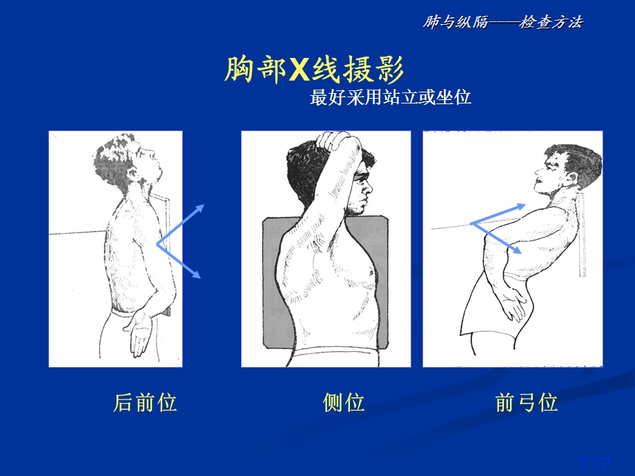 胸部影像诊断.ppt_第2页