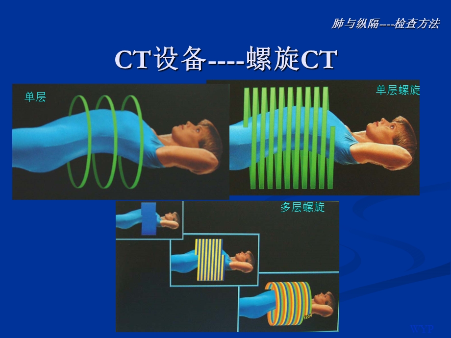 胸部影像诊断.ppt_第3页