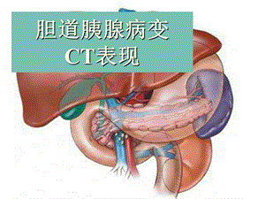 胆胰腺CT.ppt