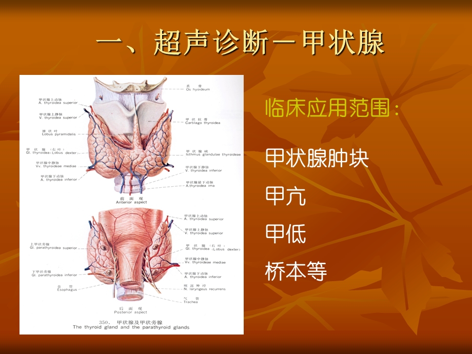 超声诊断浅表器官医学幻灯片.ppt_第3页