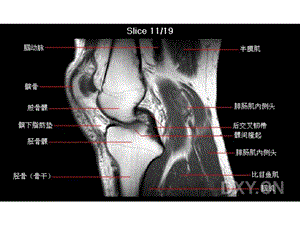 膝部MRI解剖.ppt