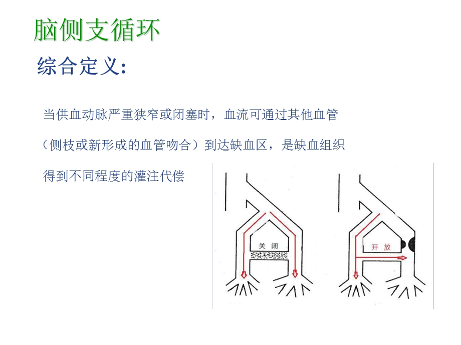 缺血性脑卒中的侧支循环评估.ppt_第2页