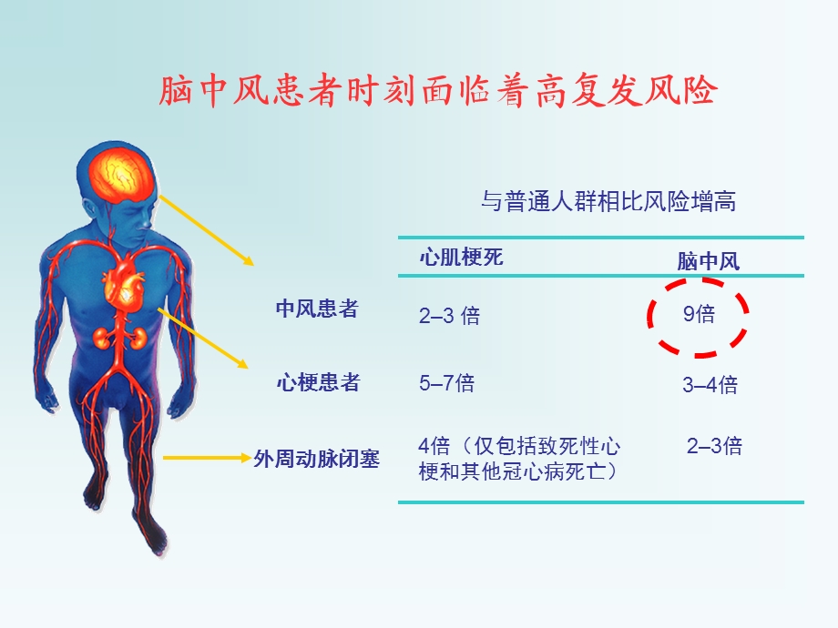 如何预防脑中风.ppt_第3页