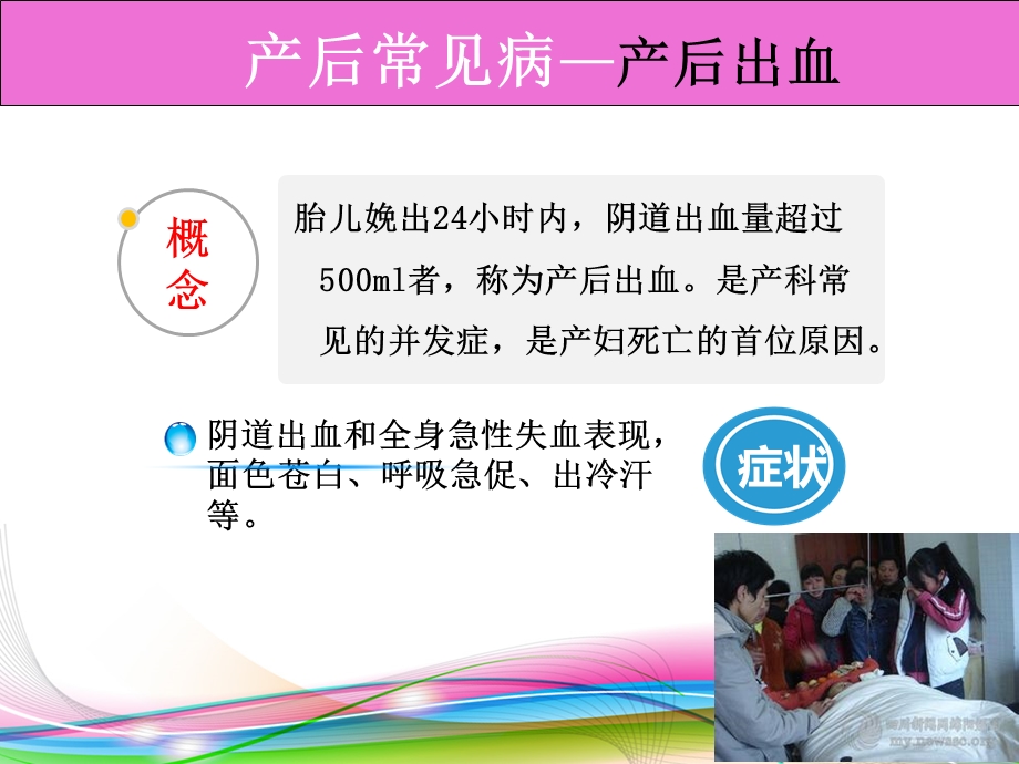 产后常见疾病的预防.ppt_第2页