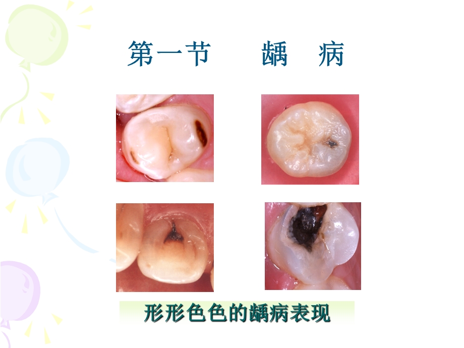 牙体硬组织疾病.ppt_第2页