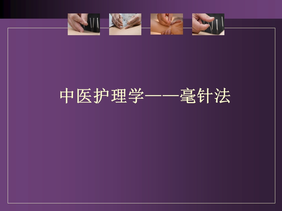 中医护理——毫针.ppt_第1页