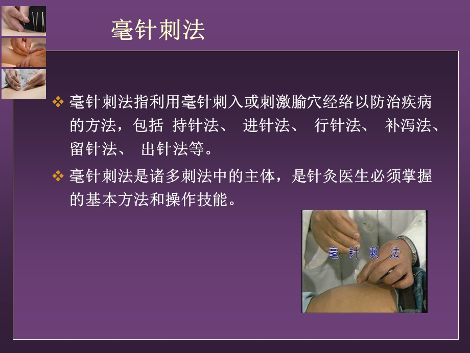 中医护理——毫针.ppt_第2页