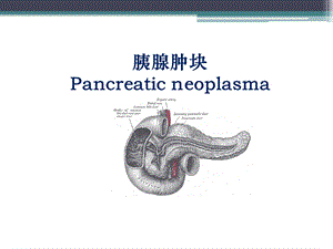 胰腺肿瘤.ppt.ppt