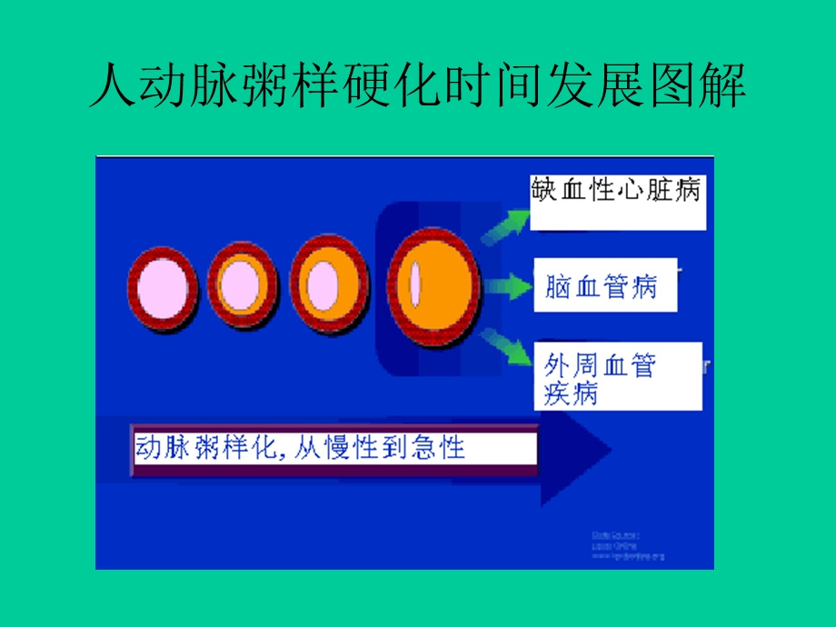 急性冠脉病症的病理机制.ppt_第2页