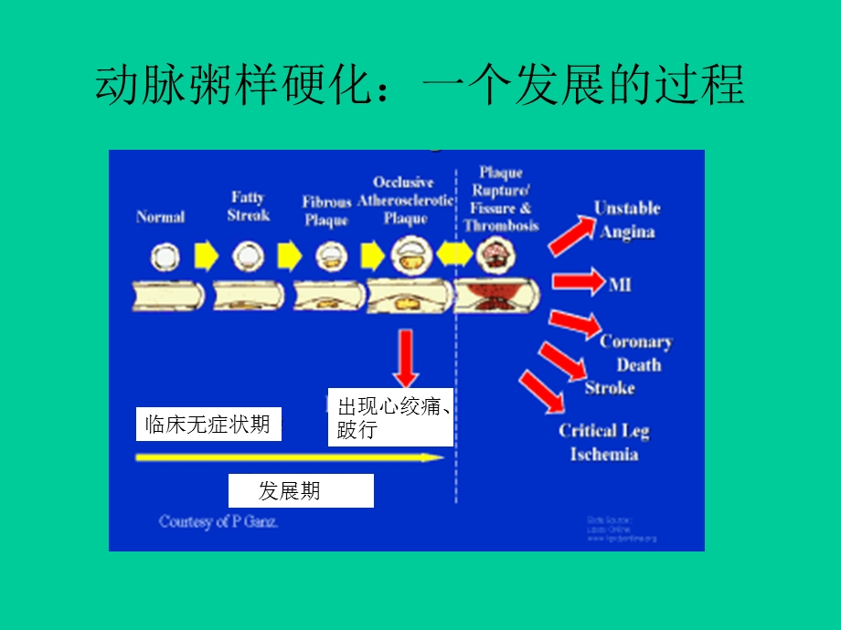 急性冠脉病症的病理机制.ppt_第3页