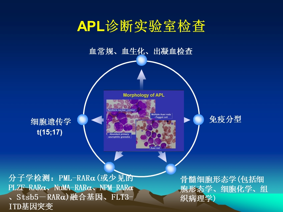 急性早幼粒细胞白血病.ppt_第2页