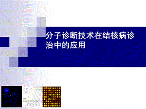 分子诊断技术在结核病诊治中的应用.ppt