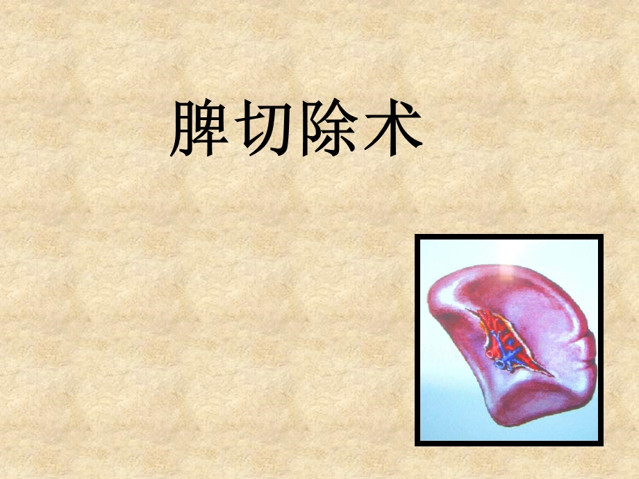 脾切除术.ppt_第1页