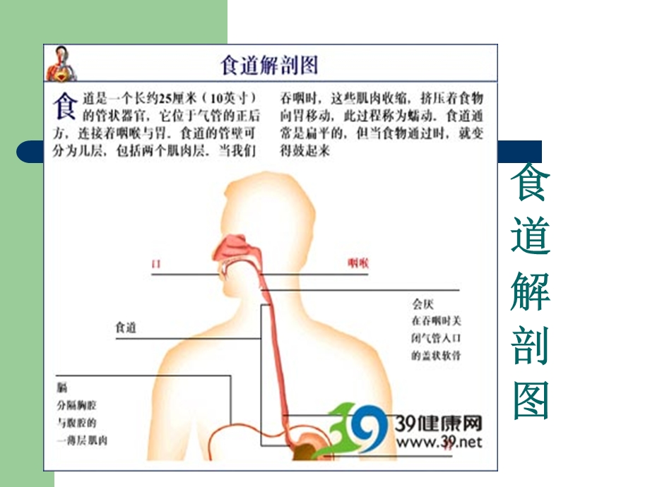 食管癌的介入治疗.ppt_第3页