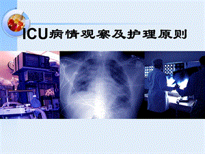 ICU病情观察及护理原则.ppt