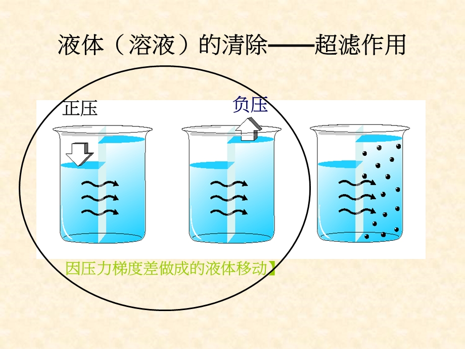 CVVH治疗剂量的计算.ppt_第3页