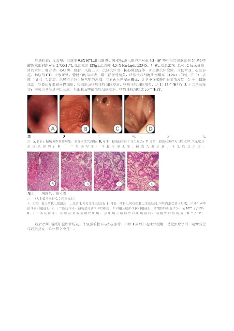 儿童嗜酸细胞性胃肠炎2例并文献复习.docx_第3页