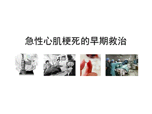 急性心肌梗死的早期救治策略.ppt