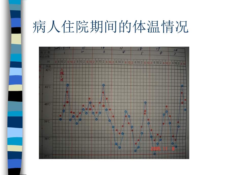 儿科病例讨论.ppt_第3页