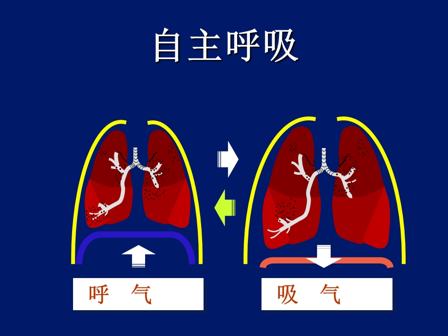 呼吸机波形及其临床意义.ppt_第3页