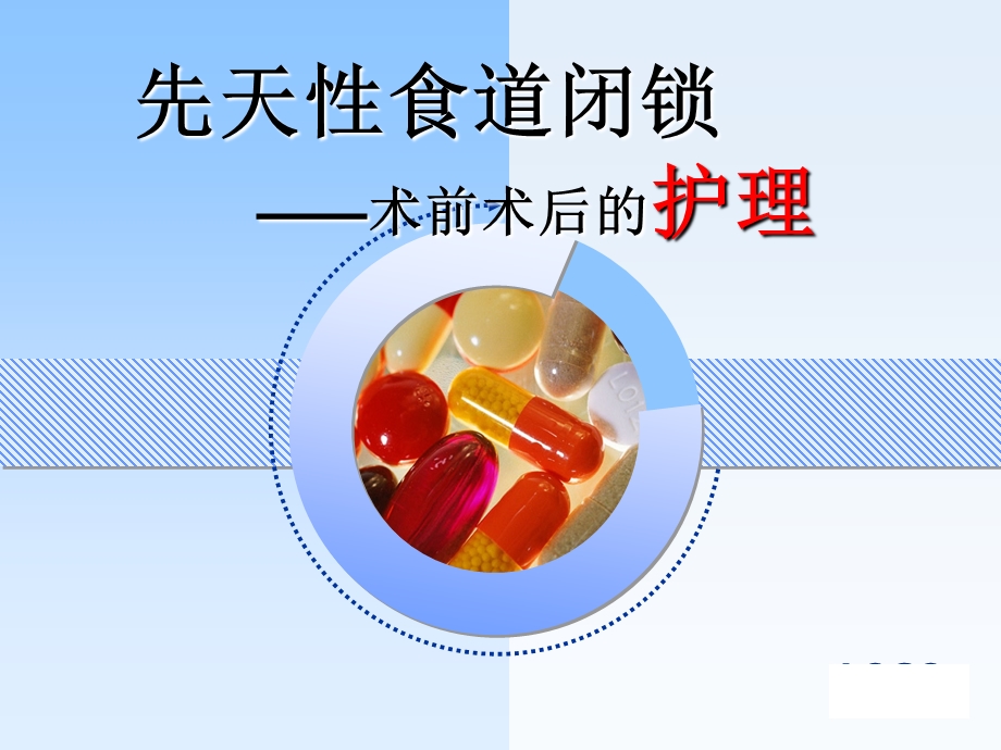 食道闭锁.ppt.ppt_第1页