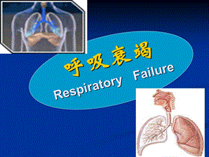 呼吸衰竭1.ppt