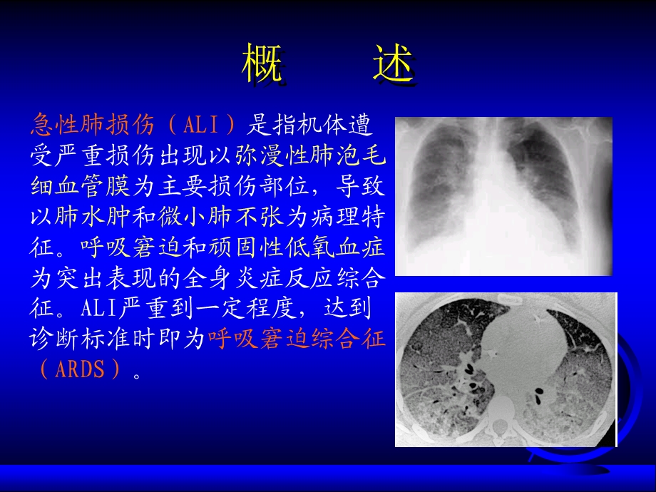 急性肺损伤和ARDS.ppt_第3页