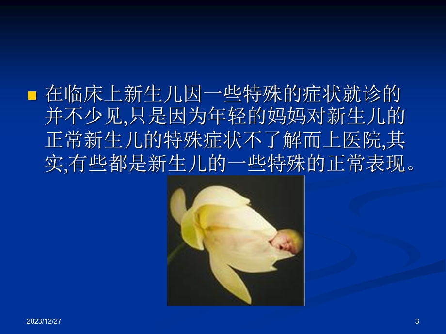 新生儿常见的生理现象.ppt_第3页