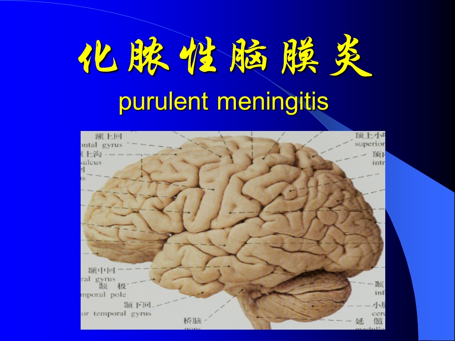 化脓性脑膜炎1.ppt_第1页